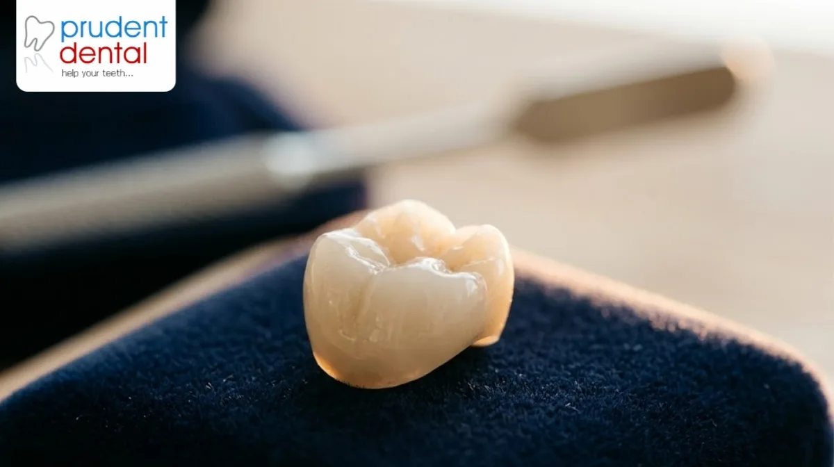 Tooth filling cost: what actually determines it