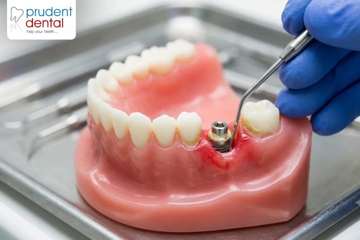 Stock photo of a dentist reviewing a dental X-ray with a patient in a modern clinic