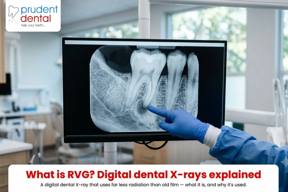 A gloved hand pointing at a dental monitor showing a digital RVG X-ray of a molar