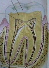 root cannel treatment
